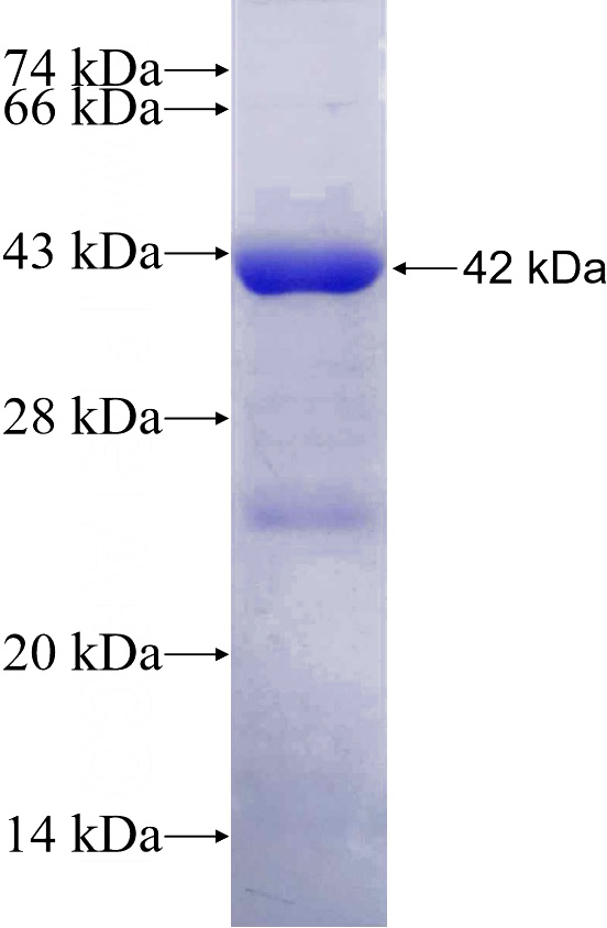 Recombinant Human EIF4G2 SDS-PAGE