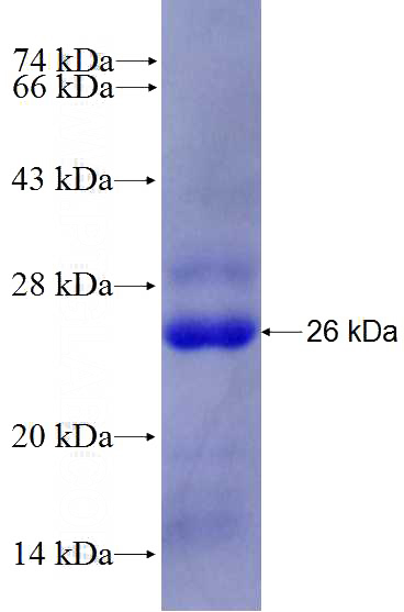 Recombinant Human ZPLD1 SDS-PAGE
