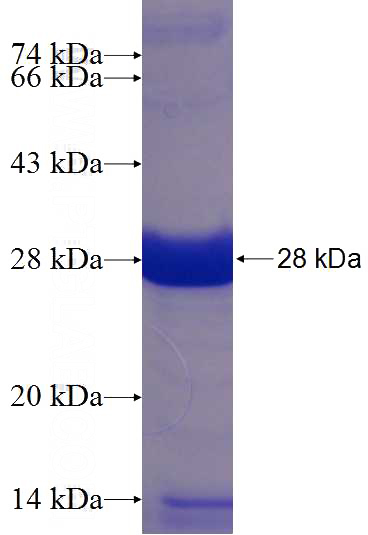 Recombinant Human TCTEX1D4 SDS-PAGE