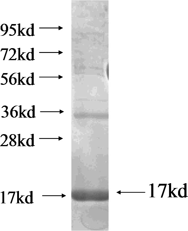 Recombinant Human DNAJC10 SDS-PAGE