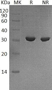 Human IMPA2/IMP.18P (His tag) recombinant protein