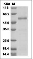 Mouse R-Spondin 2 / FTLS / RSPO2 Protein (Fc Tag) SDS-PAGE