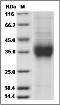 Mouse NKG2A / NKG2 / CD159A / KLRC1 Protein (His Tag) SDS-PAGE