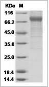 Influenza B (B/Massachusetts/03/2010) Hemagglutinin / HA0 Protein