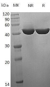 Human IDH1/PICD (His tag) recombinant protein