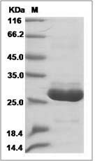 Human APOA1BP / AIBP Protein (His Tag)