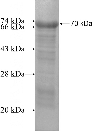 Recombinant Human C13orf18 SDS-PAGE