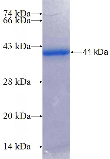 Recombinant Human C14orf49 SDS-PAGE