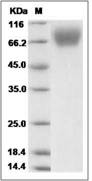 Rat TrkA / NTRK1 Protein (His Tag) SDS-PAGE