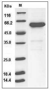 Human CD73 / NT5E Protein (His Tag) SDS-PAGE