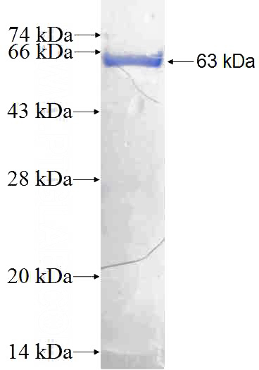 Recombinant Human GPKOW SDS-PAGE