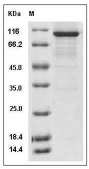 Human DCAMKL1 / DCLK1 Protein (aa 1-705, His & GST Tag) SDS-PAGE