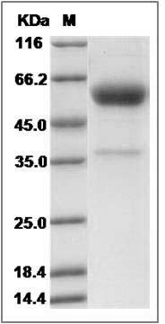 Rat CD153 / CD30L / TNFSF8 Protein (Fc Tag) SDS-PAGE