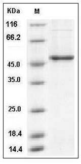 Mouse GSK3B Protein (His Tag) SDS-PAGE