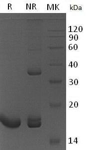 Human PRDX5/ACR1/SBBI10 (His tag) recombinant protein