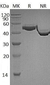 Human CFH/HF/HF1/HF2 (His tag) recombinant protein