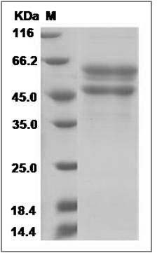 Human IGFLR1 / TMEM149 Protein (Fc Tag) SDS-PAGE