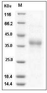 Human IL17RB / IL-17 Receptor B Protein (Flag Tag) SDS-PAGE