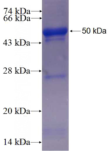 Recombinant Human PCID2 SDS-PAGE