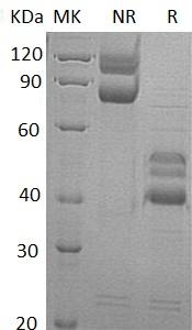 Human RELT/TNFRSF19L (Fc tag) recombinant protein