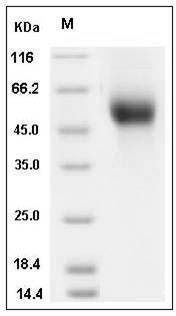 Influenza A H1N1 (A/Beijing/22808/2009) Hemagglutinin Protein (HA1 Subunit) (His Tag) SDS-PAGE