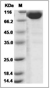 Cynomolgus IL1R1 Protein (Fc Tag) SDS-PAGE