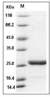 Mouse PRL / Prolactin Protein (His Tag) SDS-PAGE