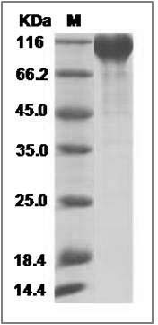 Cynomolgus Semaphorin 4D / SEMA4D / CD100 Protein (His Tag) SDS-PAGE
