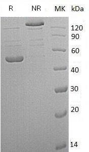 Human PRKAR1A/PKR1/PRKAR1/TSE1 (His tag) recombinant protein