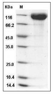 Rat ACE2 / Angiotensin-Converting Enzyme 2 Protein (His Tag) SDS-PAGE