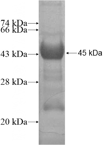 Recombinant Human DNM1 SDS-PAGE