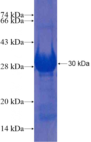 Recombinant Human PRPF38B SDS-PAGE