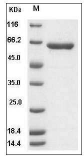 Human Hexosaminidase A / HEXA Protein (Subunit A, His Tag) SDS-PAGE