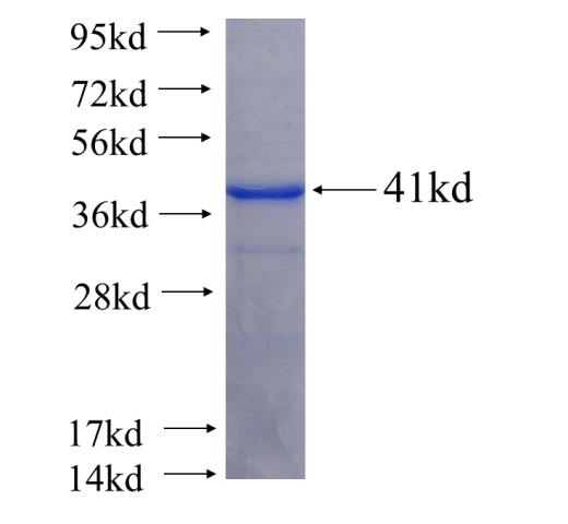 Recombinant Arabidopsis thaliana PYRB SDS-PAGE