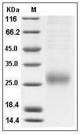 Human ALK-1 / ACVRL1 Protein (His Tag) SDS-PAGE