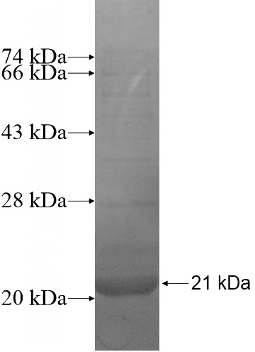 Recombinant Human LETMD1 SDS-PAGE