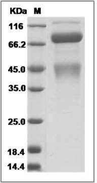 Cynomolgus / Rhesus c-MET / HGFR Protein (His Tag) SDS-PAGE
