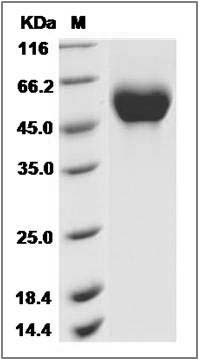 Cynomolgus IL1R1 Protein (His Tag) SDS-PAGE