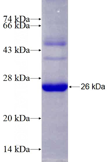 Recombinant Human ABCE1 SDS-PAGE