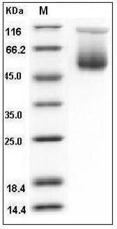 Mouse SerpinA3c Protein (His Tag) SDS-PAGE