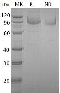 Human ERBB2/HER2/MLN19/NEU/NGL (His tag) recombinant protein