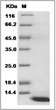 Human AHSP / ERAF Protein SDS-PAGE