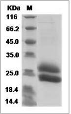 Mouse IL-28B / IFN-lambda-3 Protein (His Tag) SDS-PAGE