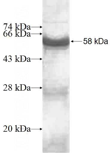 Recombinant Human UTP23 SDS-PAGE