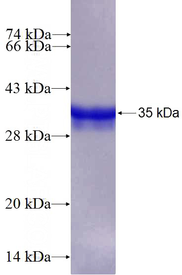 Recombinant Human RPS21 SDS-PAGE