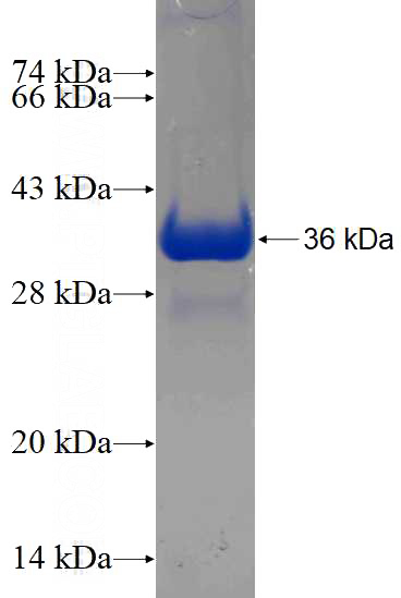 Recombinant Human CBY1 SDS-PAGE