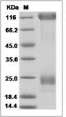 Ebola virus EBOV (subtype Zaire, strain Ebola virus H.sapiens-wt/SLE/2014/ManoRiver-G3686.1) Glycoprotein / EBOV-G Protein (His Tag)