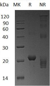 Human NHP2/NOLA2/HSPC286 (His tag) recombinant protein