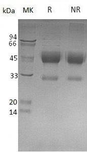 Human NXPH1/NPH1/Nbla00697 (His tag) recombinant protein