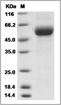 Human DDR2 Kinase / CD167b Protein (His Tag) SDS-PAGE